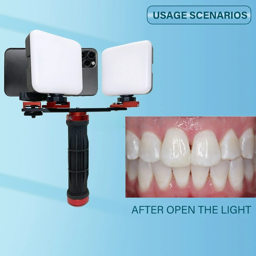 Lampe de photographie dentaire - Phone Accessories For Photography avis et prix